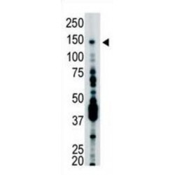 Ubiquitin Specific Peptidase 7 (USP7) Antibody