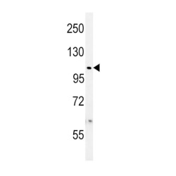 Ubiquitin Specific Peptidase 8 (USP8) Antibody