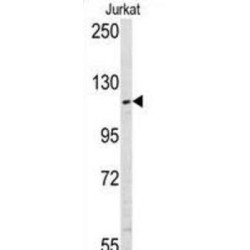 Ubiquitin Carboxyl-Terminal Hydrolase 11 (USP11) Antibody