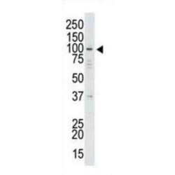 Ubiquitin Carboxyl-Terminal Hydrolase 13 (USP13) Antibody