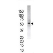 Ubiquitin Carboxyl-Terminal Hydrolase 14 (USP14) Antibody