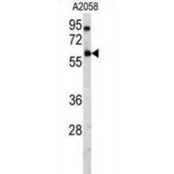 Ubiquitin Carboxyl-Terminal Hydrolase 14 (USP14) Antibody