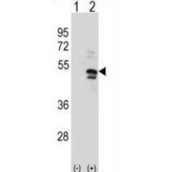 Ubiquitin Carboxyl-Terminal Hydrolase 14 (USP14) Antibody