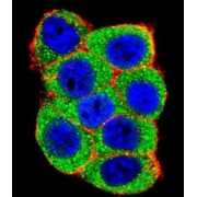 Ubiquitin Protein Ligase E3A (UBE3A) Antibody