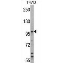 Ubiquitin Protein Ligase E3A (UBE3A) Antibody