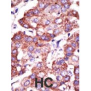 Toll-Interacting Protein (TOLLIP) Antibody