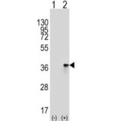 Toll-Interacting Protein (TOLLIP) Antibody