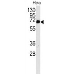 DSK2 Homolog (UBQLN2) Antibody