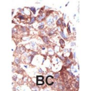 Ubiquilin 1 (UBQLN1) Antibody