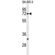 E3 Ubiquitin-Protein Ligase Synoviolin (HRD1) Antibody