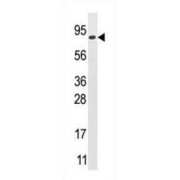 Mannosyl-Oligosaccharide Glucosidase (GCS1) Antibody