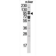 Mannosyl-Oligosaccharide Glucosidase (GCS1) Antibody