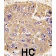 Methionine Aminopeptidase 2 Antibody