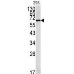 Methionine Aminopeptidase 2 Antibody