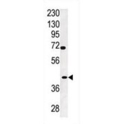 Protein-Tyrosine Sulfotransferase 2 (TPST2) Antibody