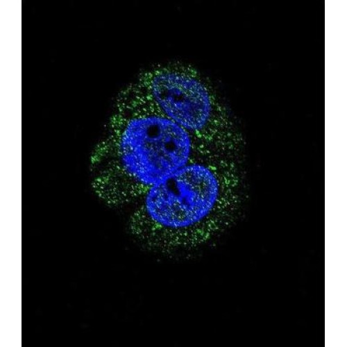 Glycogen Debranching Enzyme AGL Antibody Abbexa Ltd