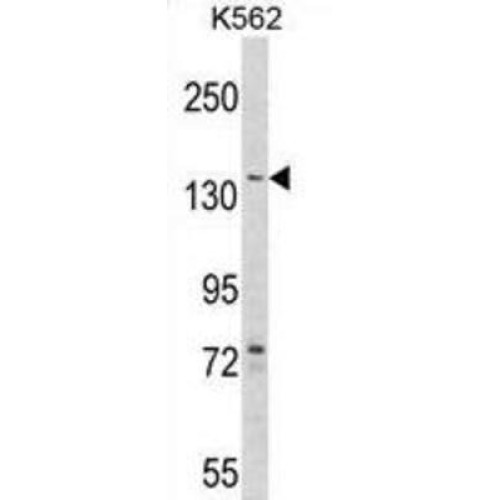 Glycogen Debranching Enzyme AGL Antibody