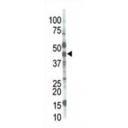 Mannosyl (Alpha-1,3-)-Glycoprotein Beta-1,2-N-Acetylglucosaminyltransferase (MGAT1) Antibody