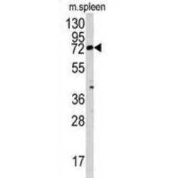 Beta-1,4-Mannosyl-Glycoprotein 4-Beta-N-Acetylglucosaminyltransferase (MGAT3) Antibody