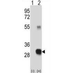 CAAX Prenyl Protease 2 (RCE1) Antibody