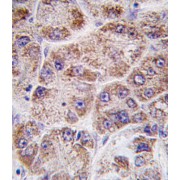 Farnesyl Diphosphate Synthase (FDPS) Antibody