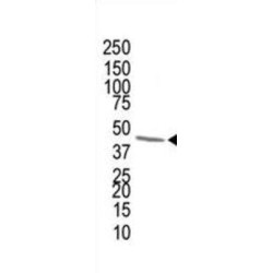 Farnesyl Diphosphate Synthase (FDPS) Antibody