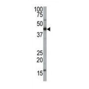 Farnesyltransferase Alpha (FNTA) Antibody