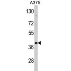 Farnesyltransferase Alpha (FNTA) Antibody