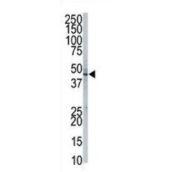 GPI8 Antibody