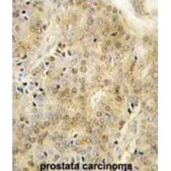 Enhancer Of Zeste Homolog 1 (EZH1) Antibody