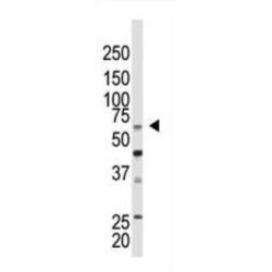 E3 SUMO-Protein Ligase CBX4 (CBX4) Antibody