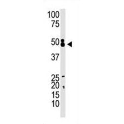 Chromobox Protein Homolog 8 (CBX8) Antibody