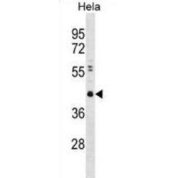 Chromobox Protein Homolog 8 (CBX8) Antibody