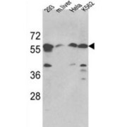 Serine Palmitoyltransferase, Long Chain Base Subunit 1 (SPTLC1) Antibody