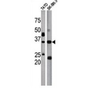 WB analysis of T47D (left) and SK-BR-3 (right) cell lysates using ICMT antibody.