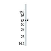 Protein-Arginine Deiminase Type-4 (PAD4) Antibody