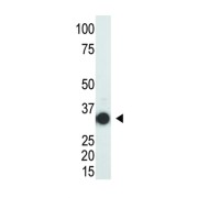 SULT2A Antibody