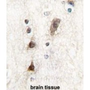 Pancreas Specific Transcription Factor 1a (Ptf1a) Antibody