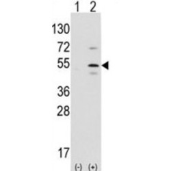 Pancreas Specific Transcription Factor 1a (Ptf1a) Antibody