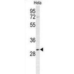 Prohibitin (PHB) Antibody