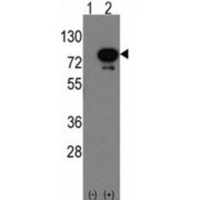 Deformed Epidermal Autoregulatory Factor 1 Homolog (Deaf1) Antibody