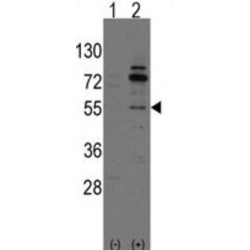 Rho Guanine Nucleotide Exchange Factor 9 (ARHGEF9) Antibody