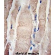 Phosphohistidine Phosphatase 1 (PHPT1) Antibody