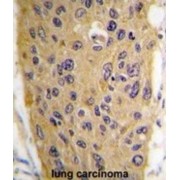 Wnt Inhibitory Factor 1 (WIF1) Antibody