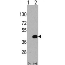 Wnt Inhibitory Factor 1 (WIF1) Antibody