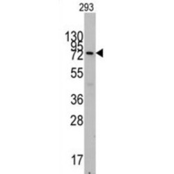 Cadherin 5 (CDH5) Antibody