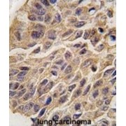 Indoleamine 2,3-Dioxygenase 1 (INDO) Antibody