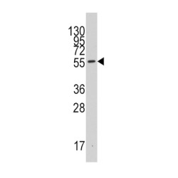 Indoleamine 2,3-Dioxygenase 1 (INDO) Antibody