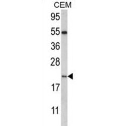 Nanos C2HC-Type Zinc Finger 2 (NANOS2) Antibody