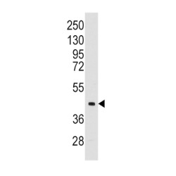 Aldolase C, Fructose Bisphosphate (ALDOC) Antibody